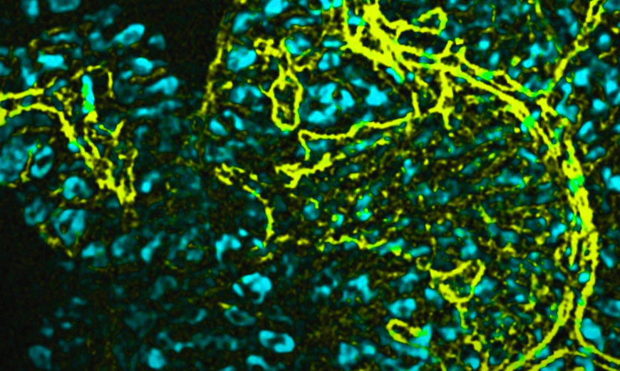 嚢胞性線維症を患っている人のためのストレッチ